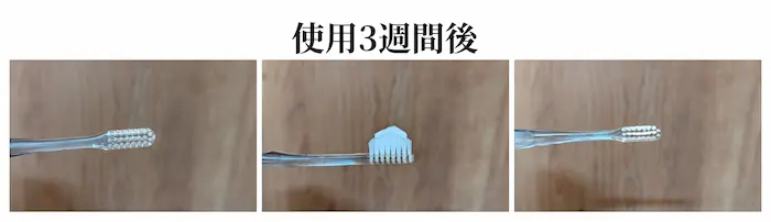 奇跡の歯ブラシ 使用3週間後