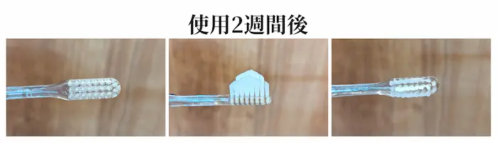 奇跡の歯ブラシ 使用2週間後
