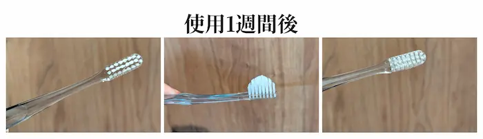 奇跡の歯ブラシ 使用1週間後
